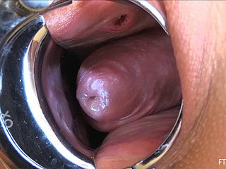 Roxy là ở đây để chỉ cho chúng ta cách sâu sắc và dispirited của cô âm đạo thực sự là