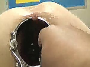 spekulum dubur mengejutkan ternganga dan fisting